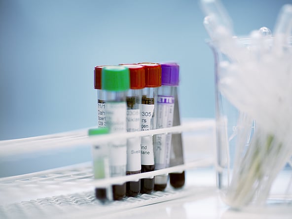 Een groep reageerbuisjes in een rek.