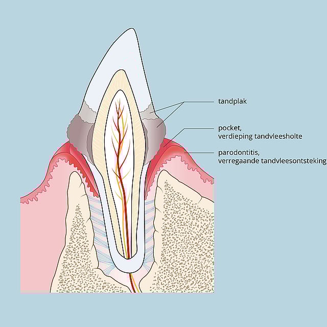 Een diagram van een tand.
