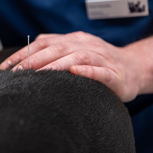 acupunctuur