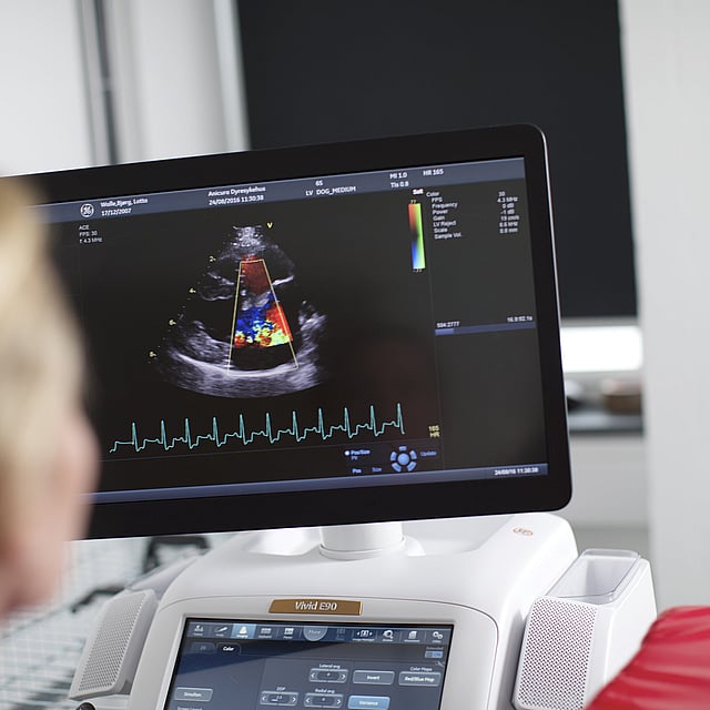 Echografie of scherm