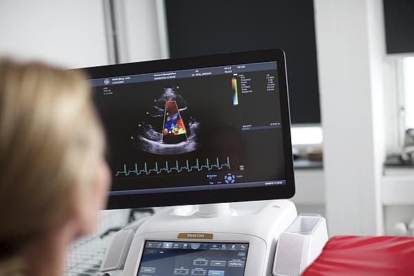 Echografie of scherm