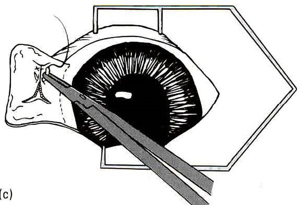 Een zwart-wit tekening van een menselijk oog.
