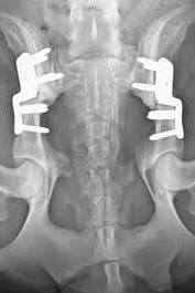 Radiographie du bassin d’une personne.