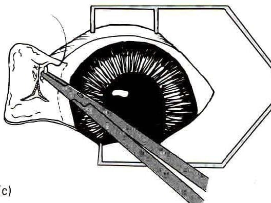 Un dessin en noir et blanc d’un œil humain.