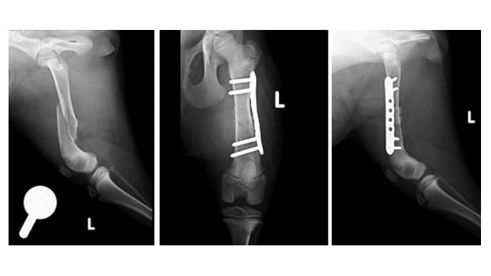 Radiographie d’un os cassé.