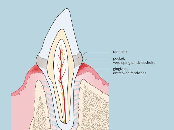 Een diagram van een tand.