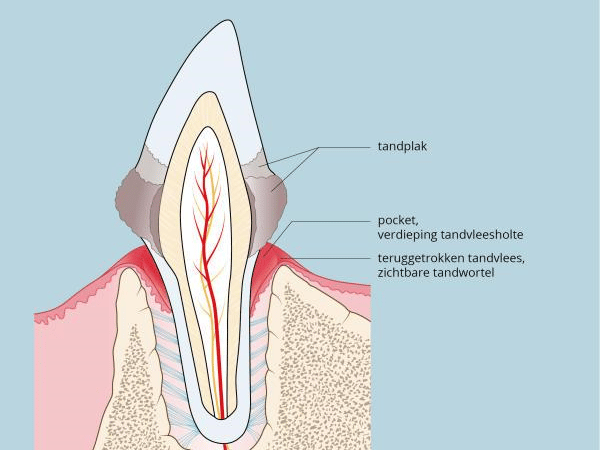 Een diagram van een tand.