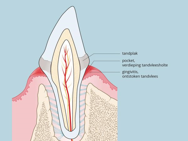 Een diagram van een tand.