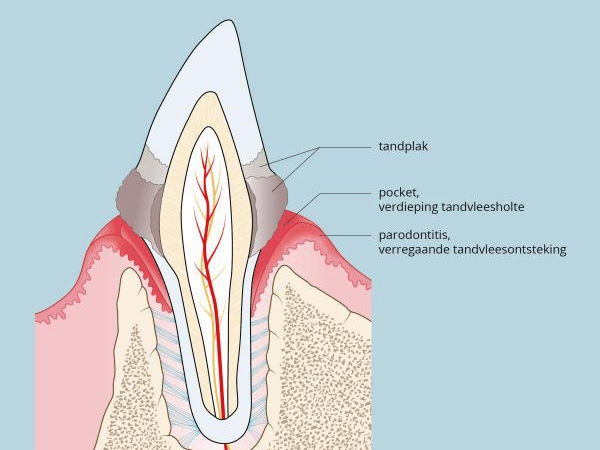 Een diagram van een tand.