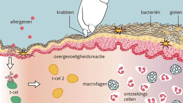 Een diagram van een menselijke huid.