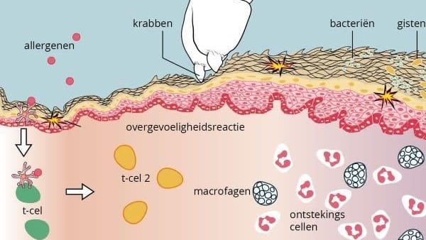 Diagram van huidanatomie met tekst en afbeeldingen.