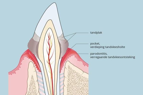 Een diagram van een tand.