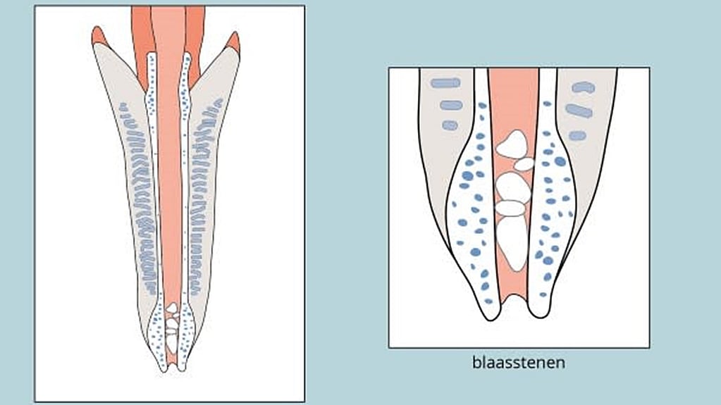 Een diagram van tanden en een diagram van tanden.