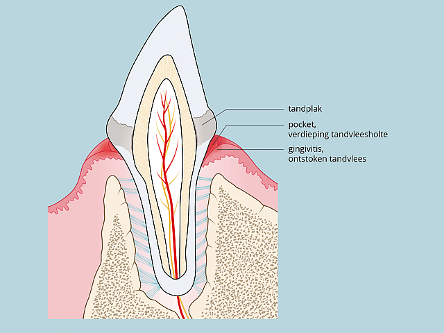 Een diagram van een tand.