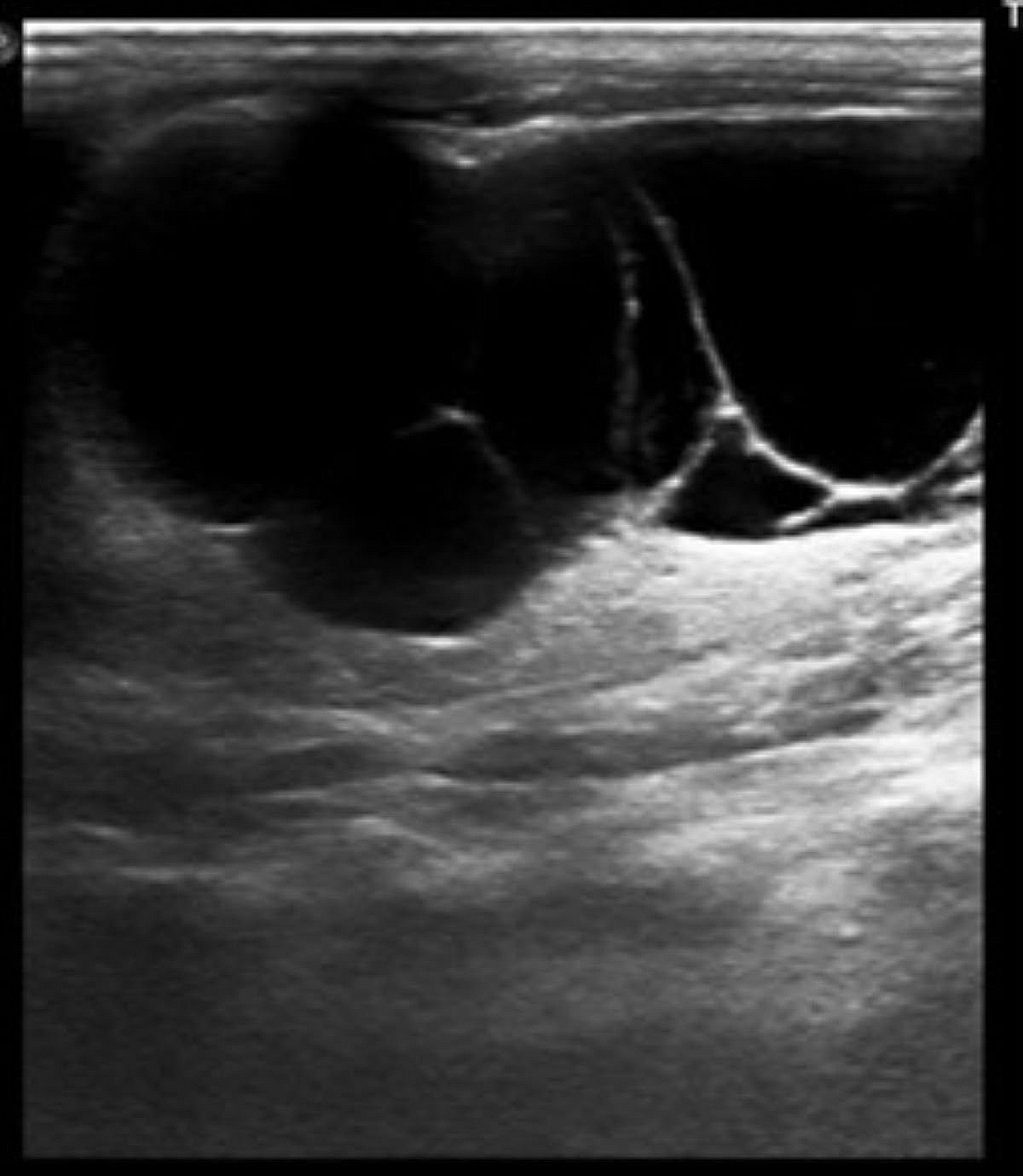 Een close-up van een echografie.
