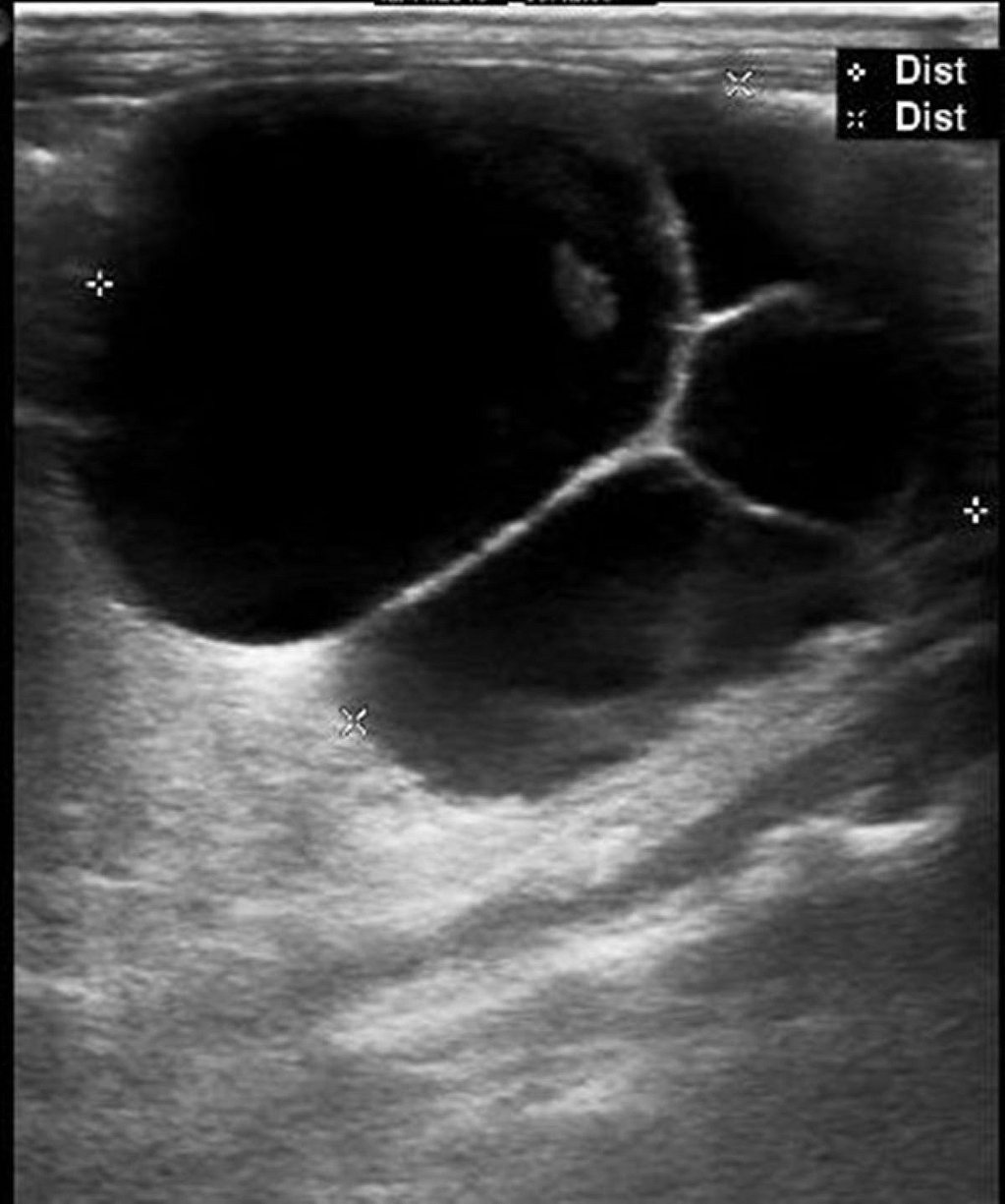 Een echografie van een foetus.
