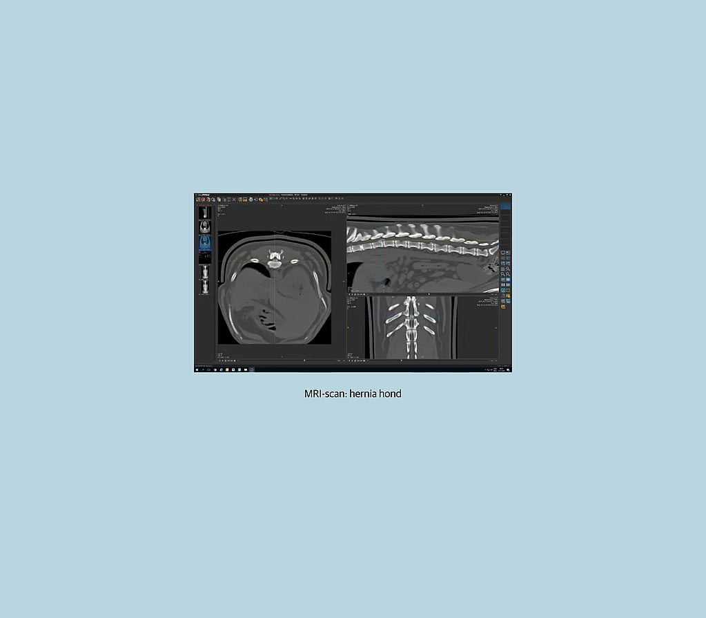 Un écran d’ordinateur avec des images radiographiques.