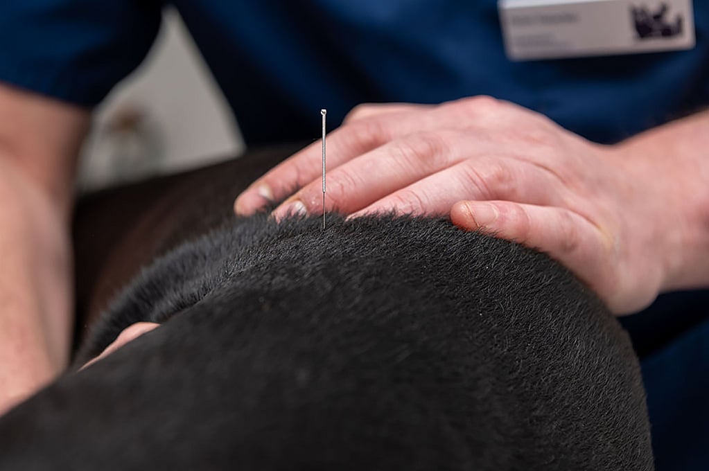 Een persoon die een naald gebruikt voor acupunctuur.