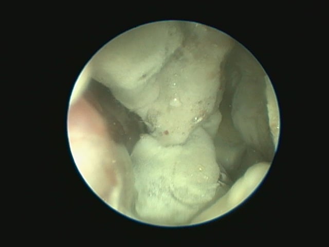 Een close-up van een microscoop.