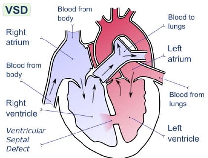 Een diagram van het hart.