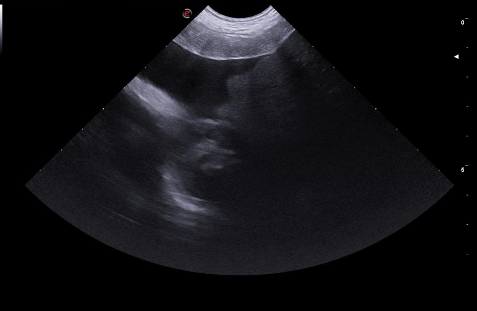 Een echo van een baby.