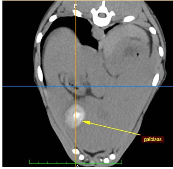Een close-up van een CT-scan.