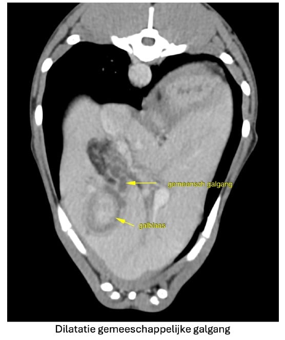 Een CT-scan van een menselijk lichaam.
