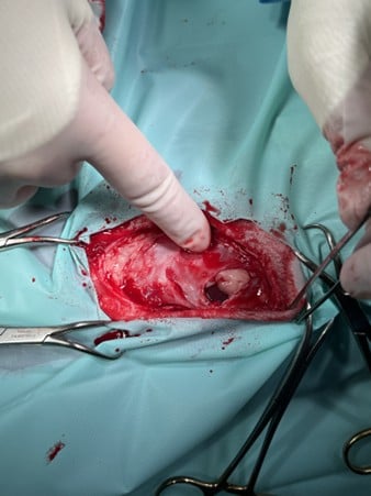 De vinger van een persoon die naar een open snee wijst.